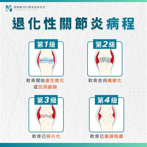 為什麼會骨枯|【髖關節炎】常見4大成因：關節退化、骨折 痛楚持續。